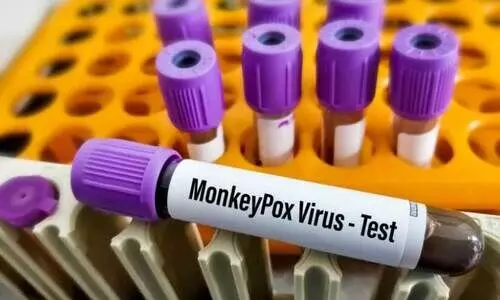 കരുതൽ വേണമെന്ന് മന്ത്രാലയം: മൂന്നു പേർക്കുകൂടി വാനരവസൂരി