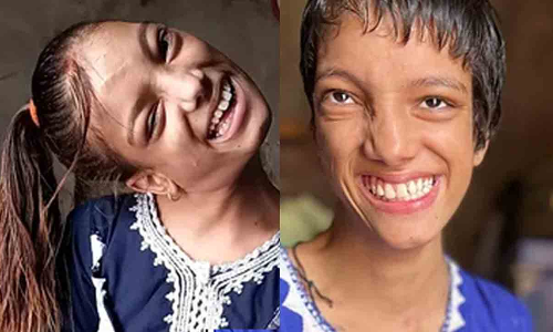 നന്ദി ഇന്ത്യ! 10ാം മാസം വീണ് കഴുത്തൊടിഞ്ഞ പാകിസ്താൻ പെൺകുട്ടി 12 വർഷത്തിന് ശേഷം ഡൽഹിയിലെ ചികിത്സയി​ൽ സുഖംപ്രാപിച്ചു