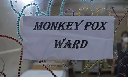 മങ്കിപോക്സ്: പുരുഷൻമാർ ലൈംഗിക പങ്കാളികളുടെ എണ്ണം കുറക്കണമെന്ന് ലോകാരോഗ്യസംഘടന