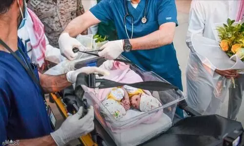 യമനി സയാമീസുകൾ നാളെ വേർപെടും