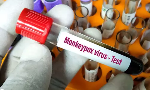 monkey pox monkey pox