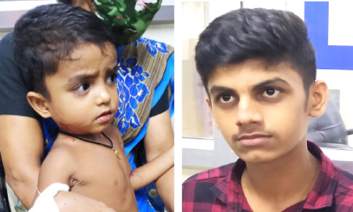 നാ​ലു വ​യ​സ്സു​കാ​ര​നെ തെ​രു​വു​നാ​യി​ൽ​നി​ന്ന് 15കാ​ര​ൻ ര​ക്ഷ​പ്പെ​ടു​ത്തി