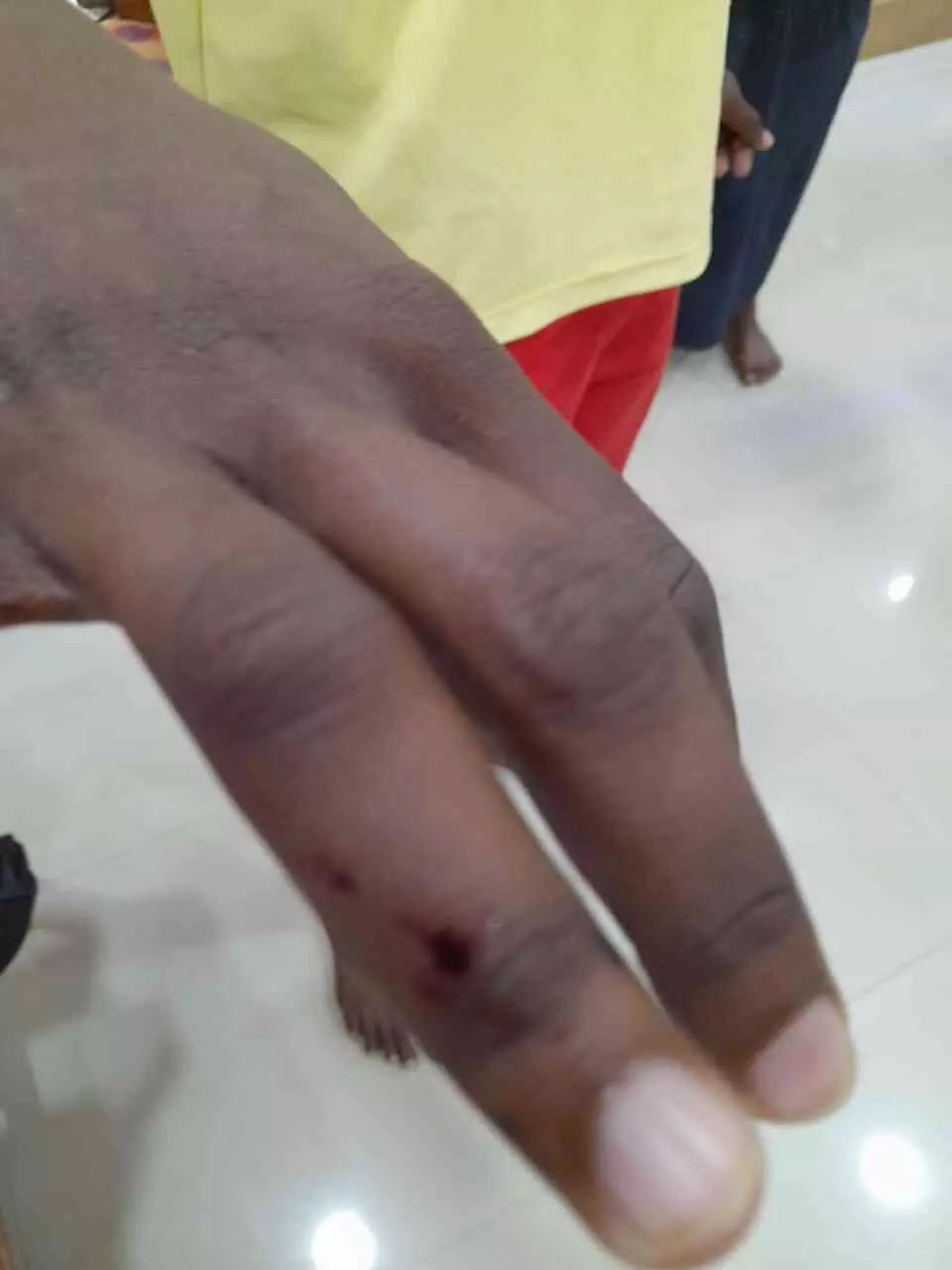 തെരുവുനായ് ആക്രമണം തെരുവുനായ് ആക്രമണം