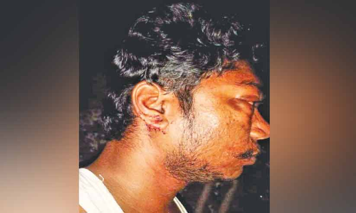 കഞ്ചാവ് ഉപയോഗത്തെ എതിർത്ത ഡി.വൈ.എഫ്.ഐ പ്രവർത്തകനുനേരെ സംഘടിത ആക്രമണം