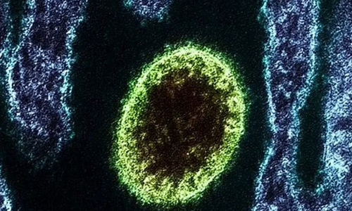 ചൈനയിൽ പുതിയ വൈറസ്ബാധ; 35 പേർക്ക് ബാധിച്ചു