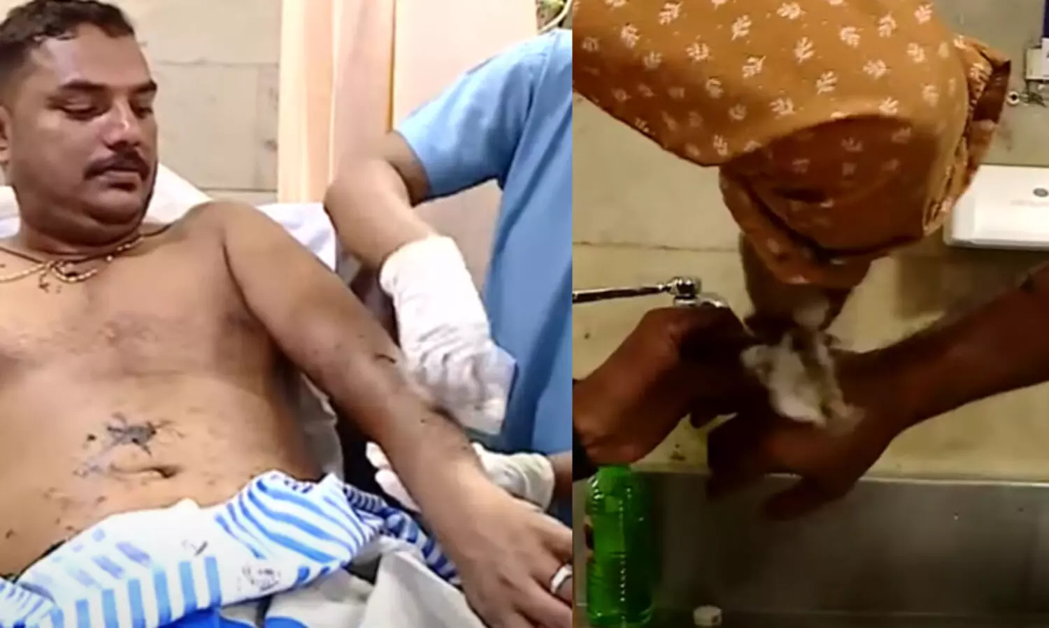 യാത്രക്കാരെ ടാർ ഒഴിച്ച് പൊള്ളിച്ച് റോഡ് അറ്റകുറ്റപ്പണിക്കാരൻ; ഗുരുതര പരിക്ക്