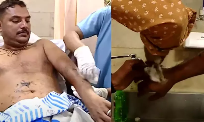 യാത്രക്കാരെ ടാർ ഒഴിച്ച് പൊള്ളിച്ച് റോഡ് അറ്റകുറ്റപ്പണിക്കാരൻ; ഗുരുതര പരിക്ക് യാത്രക്കാരെ ടാർ ഒഴിച്ച് പൊള്ളിച്ച് റോഡ് അറ്റകുറ്റപ്പണിക്കാരൻ; ഗുരുതര പരിക്ക്