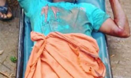 പാലോട് കാട്ടുപന്നിയുടെ കുത്തേറ്റ് ഒരാൾക്ക് ഗുരുതര പരിക്ക്