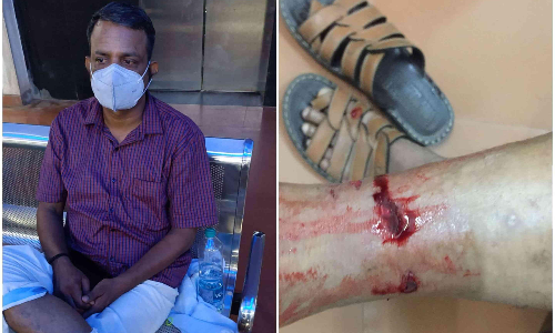 തെരുവുനായയുടെ കടിയേറ്റ് പൊലീസുകാരന് പരിക്ക്