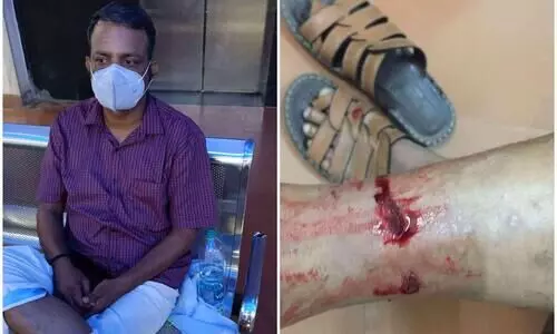 തെരുവുനായയുടെ കടിയേറ്റ് പൊലീസുകാരന് പരിക്ക്