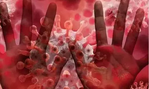 വാനരവസൂരി: തൃശൂർ ഗവ. മെഡിക്കൽ കോളജിൽ പി.സി.ആർ പരിശോധന