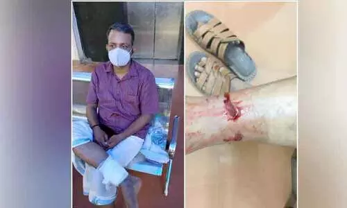 എ.എസ്​.ഐക്കടക്കം നായുടെ കടിയേറ്റു