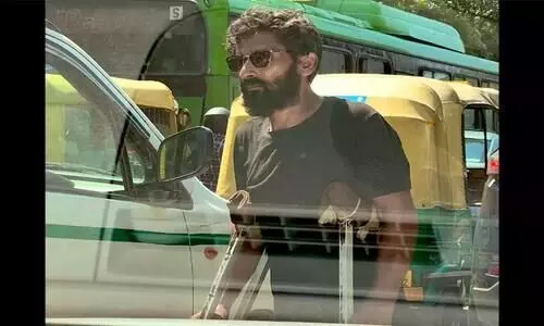 Photo of Delhi beggar looking like a model goes viral