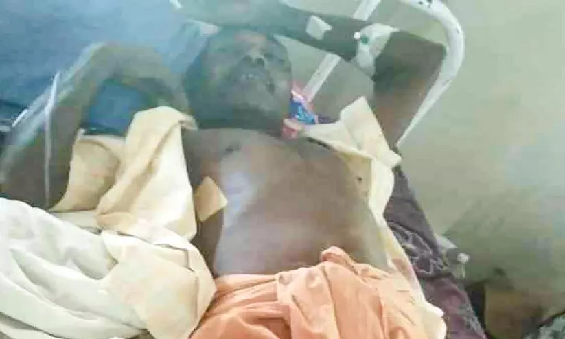 കാട്ടുപന്നി ആക്രമണത്തിൽ ടാപ്പിങ് തൊഴിലാളിക്ക് പരിക്ക് കാട്ടുപന്നി ആക്രമണത്തിൽ ടാപ്പിങ് തൊഴിലാളിക്ക് പരിക്ക്