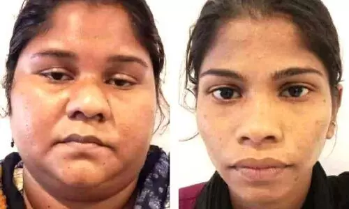 ബസിൽ നിന്നും മാല പൊട്ടിക്കുന്ന സംഘം പൊലീസ് പിടിയിൽ