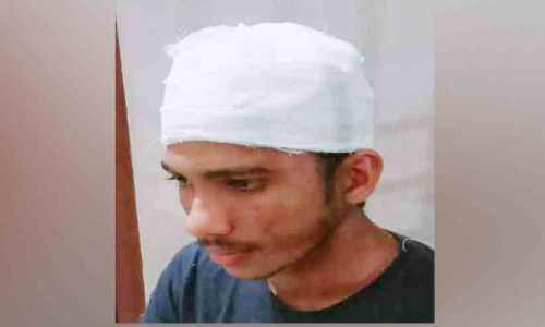 തലശ്ശേരി ബസ്സ്റ്റാൻഡിൽ സീലിങ് അടർന്നുവീണ് രണ്ട് വിദ്യാർഥികൾക്ക് പരിക്ക്