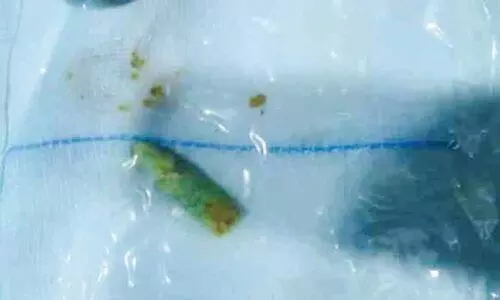 വിഴുങ്ങിയ മെഴുക് പെൻസിൽ പുറത്തെടുത്തു; ഗുരുതരാവസ്ഥ തരണംചെയ്ത് ഒന്നാം ക്ലാസുകാരൻ