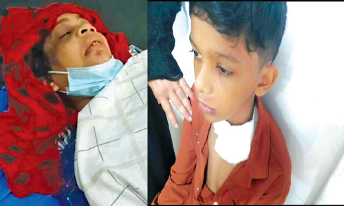 മാളിയേക്കലിൽ കാട്ടുപന്നി ആക്രമണം; മൂന്നുപേർക്ക് പരിക്ക്