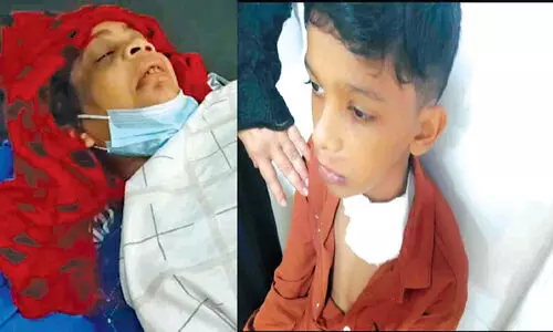 മാളിയേക്കലിൽ കാട്ടുപന്നി ആക്രമണം; മൂന്നുപേർക്ക് പരിക്ക്