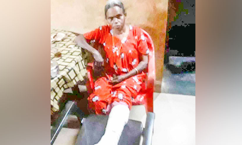 കാട്ടുപന്നിയുടെ ആക്രമണത്തിൽ വീട്ടമ്മക്ക് പരിക്ക് കാട്ടുപന്നിയുടെ ആക്രമണത്തിൽ വീട്ടമ്മക്ക് പരിക്ക്