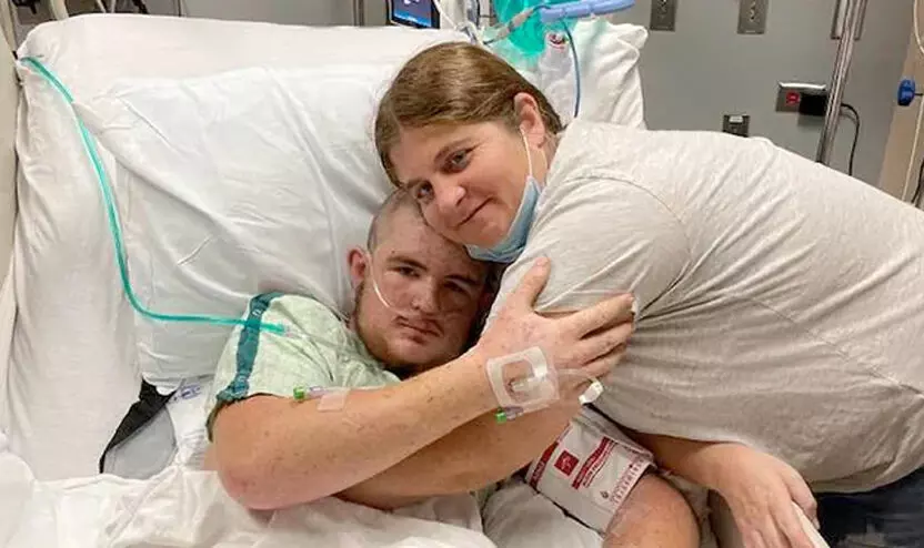 Stung by killer African bees Stung by killer African bees