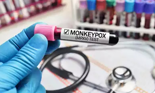 ഡൽഹിയിൽ വീണ്ടും മങ്കിപോക്സ്; ഇന്ത്യയിൽ രോഗികളുടെ എണ്ണം 11