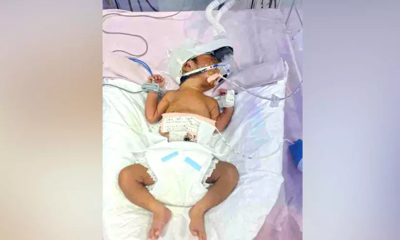 Parents seek help to save life of premature baby