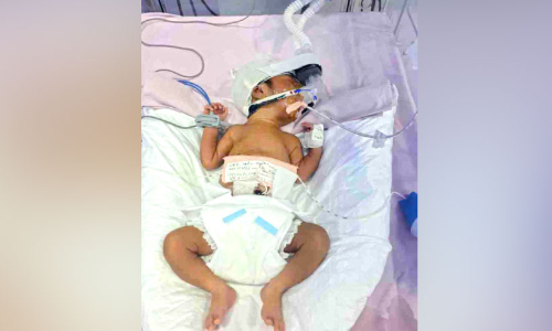 Parents seek help to save life of premature baby