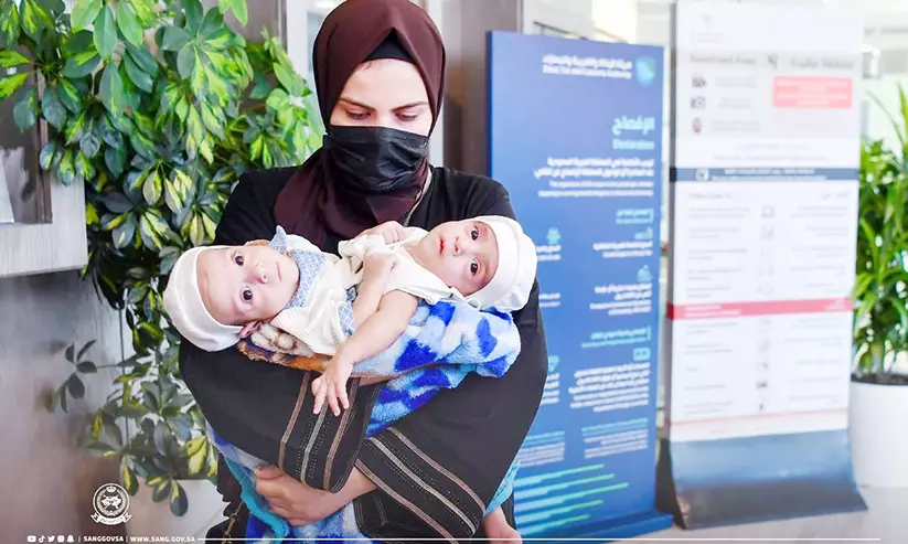 വേർപെടുത്തൽ ശസ്ത്രക്രിയക്കായി ഇറാഖി സയാമീസ് ഇരട്ടകളെ റിയാദിലെത്തിച്ചു വേർപെടുത്തൽ ശസ്ത്രക്രിയക്കായി ഇറാഖി സയാമീസ് ഇരട്ടകളെ റിയാദിലെത്തിച്ചു