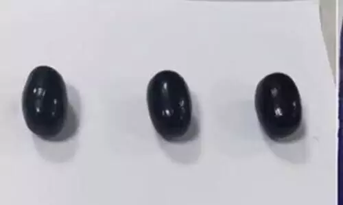 മലദ്വാരത്തില് ഒളിപ്പിച്ച് കടത്തിയ 114.87 പവൻ തങ്കം പിടികൂടി മലദ്വാരത്തില് ഒളിപ്പിച്ച് കടത്തിയ 114.87 പവൻ തങ്കം പിടികൂടി