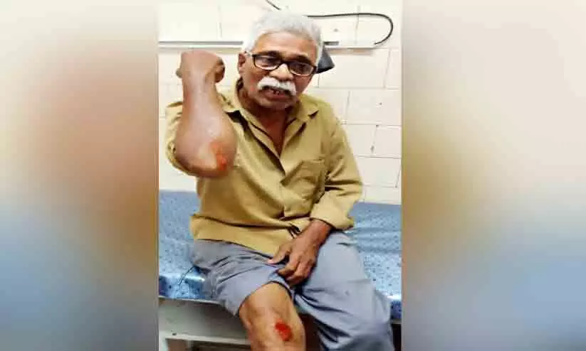 Dog jumps on top of bike