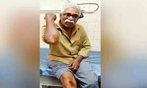 Dog jumps on top of bike