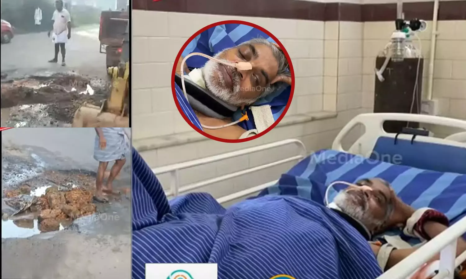 റോഡിലെ കുഴിയിൽ വീണ് ചികിത്സയിലായിരുന്നയാൾ മരിച്ചു