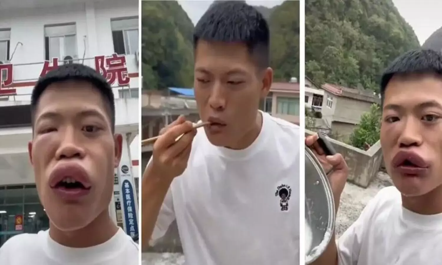 കടന്നലിനെ തിന്നാൻ ശ്രമം; ചൈനീസ് യൂട്യൂബർക്ക് കിട്ടിയത് മുട്ടൻ പണി