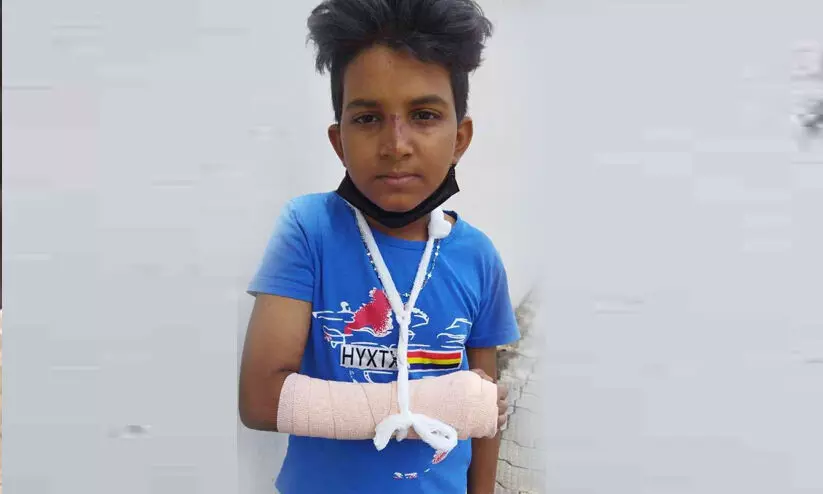 തെരുവുനായ്ക്കൾ പിന്നാലെ ഓടി, സൈക്കിളിൽനിന്ന് വീണ് വിദ്യാർഥിയുടെ കൈ പൊട്ടി