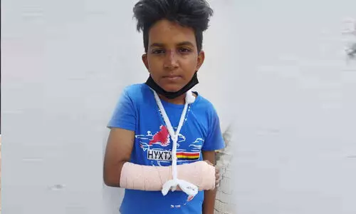 തെരുവുനായ്ക്കൾ പിന്നാലെ ഓടി, സൈക്കിളിൽനിന്ന് വീണ് വിദ്യാർഥിയുടെ കൈ പൊട്ടി