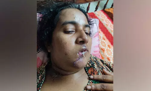 കമാനം വീണ് യുവതിക്ക് പരിക്കേറ്റ സംഭവത്തിൽ കേസെടുത്തു കമാനം വീണ് യുവതിക്ക് പരിക്കേറ്റ സംഭവത്തിൽ കേസെടുത്തു