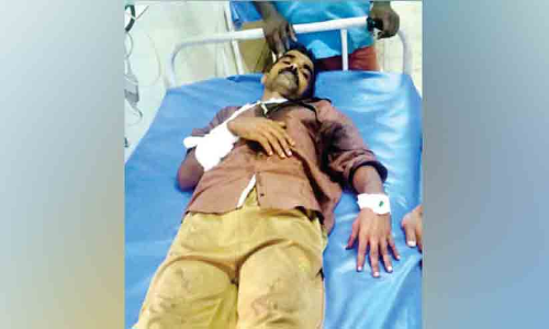 കാട്ടുപന്നിയുടെ കുത്തേറ്റ് പരിക്ക്