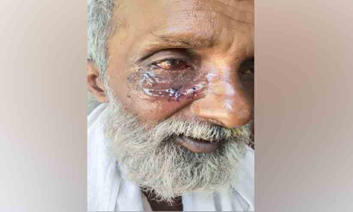 നായ് കടിച്ച് പത്ര ഏജന്റിന് ഗുരുതര പരിക്ക് നായ് കടിച്ച് പത്ര ഏജന്റിന് ഗുരുതര പരിക്ക്