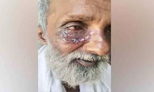 നായ് കടിച്ച് പത്ര ഏജന്‍റിന് ഗുരുതര പരിക്ക്