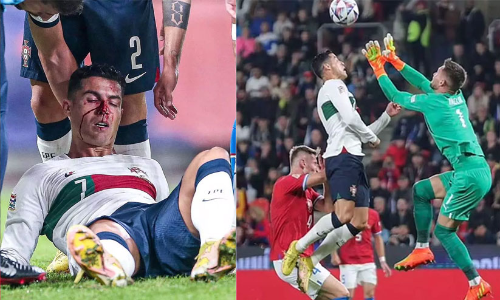 രക്തത്തിൽ കുളിച്ച് ക്രിസ്റ്റ്യാനോ; ആശങ്കയുടെ മുൾമുനയിൽ ആരാധകർ