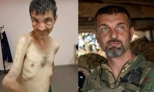 Striking photos show Mariupol soldier before and after Russian captivity