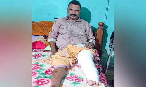 കാട്ടുപന്നിയുടെ ആക്രമണം; യുവാവിന്‍റെ കാലൊടിഞ്ഞു