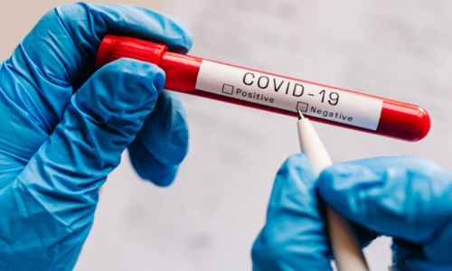 ലോകകപ്പിന്​ വരുന്നോ... നെഗറ്റീവായിരിക്കണം