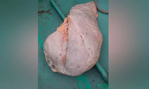 വീ​ണ്ടും വ​ല​യി​ൽ​കു​ടു​ങ്ങി തി​മിം​ഗി​ല ഛർ​ദി