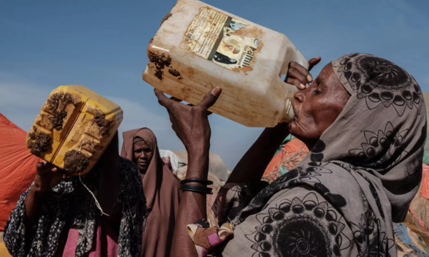 കൊടുംപട്ടിണിയുടെ പിടിയിൽ സോമാലിയ