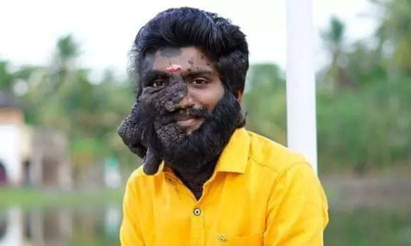 ആ പുഞ്ചിരി മാഞ്ഞു; പ്രഭുലാൽ പ്രസന്നൻ ഇനി ഓർമ ആ പുഞ്ചിരി മാഞ്ഞു; പ്രഭുലാൽ പ്രസന്നൻ ഇനി ഓർമ