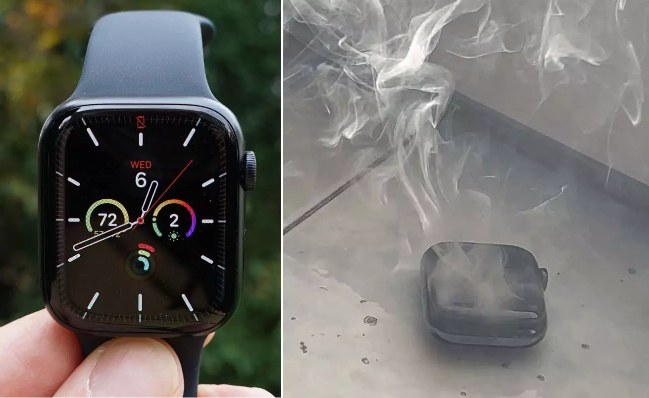 ചൂടായി, പിന്നാലെ അസ്വാഭാവിക ശബ്ദം, പൊട്ടിത്തെറി; ഞെട്ടിക്കുന്ന അനുഭവം പങ്കുവെച്ച് ആപ്പിൾ വാച്ച് യൂസർ ചൂടായി, പിന്നാലെ അസ്വാഭാവിക ശബ്ദം, പൊട്ടിത്തെറി; ഞെട്ടിക്കുന്ന അനുഭവം പങ്കുവെച്ച് ആപ്പിൾ വാച്ച് യൂസർ