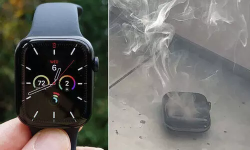 ചൂടായി, പിന്നാലെ അസ്വാഭാവിക ശബ്ദം, പൊട്ടിത്തെറി; ഞെട്ടിക്കുന്ന അനുഭവം പങ്കുവെച്ച് ആപ്പി​ൾ വാച്ച് യൂസർ