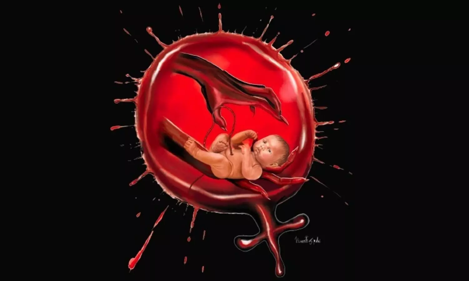 കരഞ്ഞ കുഞ്ഞിനെ ഞാൻ ബക്കറ്റിലെ വെള്ളത്തിലിട്ടു, കുഞ്ഞ് കൈയും കാലും ഇട്ടടിക്കുന്നത് കണ്ടു; ഒരമ്മ പറയുന്നു